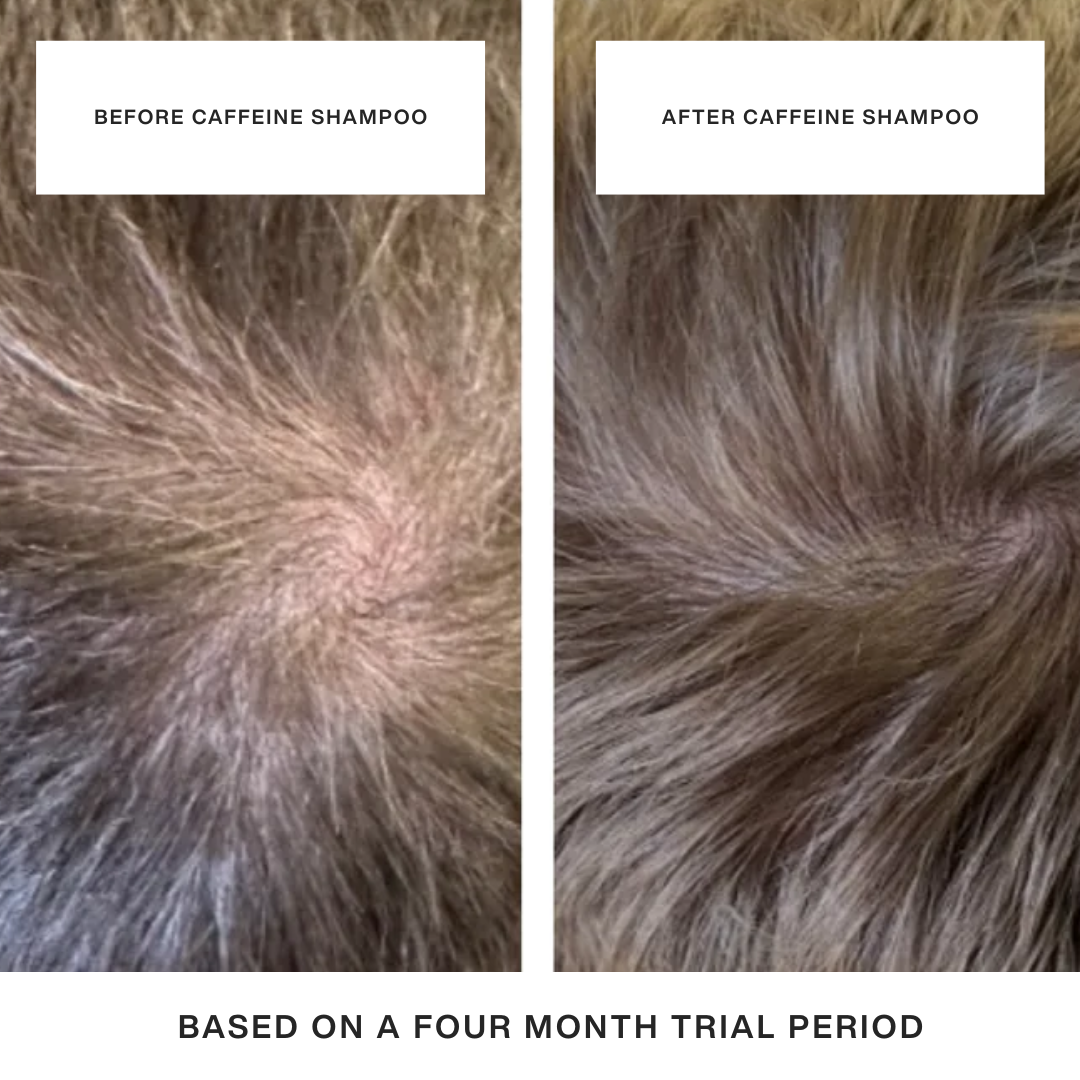 The Caffeine Hair Duo